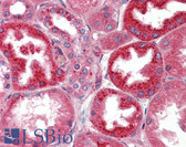 Anti-CTSL / Cathepsin L Antibody IHC-plus LS-B3637
