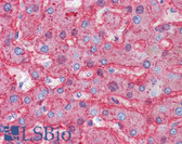 Anti-APOB / Apolipoprotein B Antibody IHC-plus LS-B3646