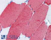 Anti-TNNT3 Antibody (clone T1/61) IHC-plus LS-B3650