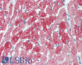 Anti-TNNT2 / CTNT Antibody IHC-plus LS-B3651