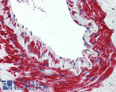 Anti-TRPM8 Antibody (N-Terminus) IHC-plus LS-A8088