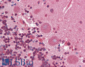 Anti-Collagen I Antibody IHC-plus LS-B3653
