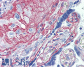 Anti-Collagen IV Antibody IHC-plus LS-B3654
