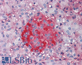 Anti-Pyruvate Kinase Antibody IHC-plus LS-B3658