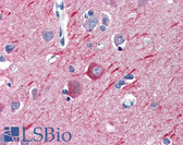 Anti-Alpha Tubulin Antibody (clone YOL1/34) IHC-plus LS-B3664