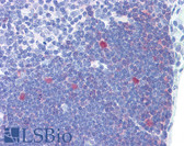 Anti-CDK1 / CDC2 Antibody (clone POH-1) IHC-plus LS-B3669
