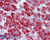 Anti-HSPD1 / HSP60 Antibody (clone LK-2) IHC-plus LS-B3678