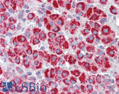 Anti-HSPD1 / HSP60 Antibody IHC-plus LS-B3679