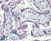 Anti-NOS3 / eNOS Antibody IHC-plus LS-B3680