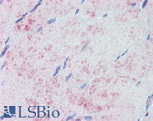 Anti-PDK1 Antibody IHC-plus LS-B3690
