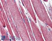 Anti-MNSOD / SOD2 Antibody IHC-plus LS-B3694