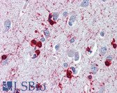 Anti-CRYAB / Alpha B Crystallin Antibody IHC-plus LS-B3696