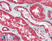 Anti-HSPD1 / HSP60 Antibody (clone Mab-11-13) IHC-plus LS-B3702