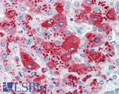 Anti-CDCP1 Antibody (Internal) IHC-plus LS-A8449