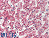 Anti-CXADR Antibody (Internal) IHC-plus LS-A8845