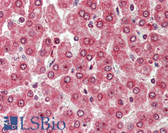 Anti-CXADR Antibody (Internal) IHC-plus LS-A8846