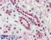 Anti-SLC44A2 / CTL2 Antibody (Internal) IHC-plus LS-A9125