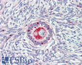 Anti-TM9SF1 Antibody (Internal) IHC-plus LS-A9225