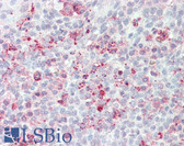 Anti-STEAP2 Antibody (Internal) IHC-plus LS-A9239
