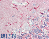 Anti-CADM2 Antibody (Internal) IHC-plus LS-A9291