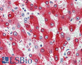Anti-CDCP1 Antibody (N-Terminus) IHC-plus LS-A8445