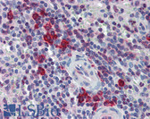 Anti-LAT2 / NTAL Antibody (aa91-243) IHC-plus LS-B3733
