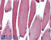 Anti-PAX3 Antibody (C-Terminus, clone C2) IHC-plus LS-B3737