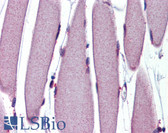 Anti-CRADD / RAIDD Antibody IHC-plus LS-B3738