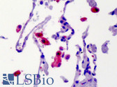 Anti-CAMK2 / CAMKII Antibody IHC-plus LS-B3743