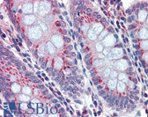 Anti-BACE2 Antibody (C-Terminus) IHC-plus LS-B3764