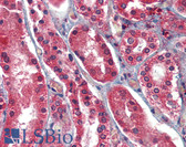 Anti-AIFM1 / AIF / PDCD8 Antibody (aa593-606) IHC-plus LS-B3765