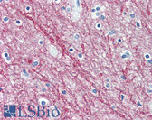 Anti-Myelin Basic Protein / MBP Antibody IHC-plus LS-B3766