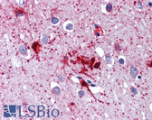 Anti-DDX58 / RIG-1 / RIG-I Antibody IHC-plus LS-B3768
