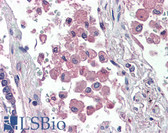 Anti-CD14 Antibody (clone 61D3) IHC-plus LS-B3769