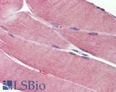 Anti-IGF1R / IGF1 Receptor Antibody IHC-plus LS-B3773