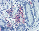 Anti-CD38 Antibody (clone HIT2) IHC-plus LS-B3774