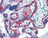 Anti-ITGB4 / Integrin Beta 4 Antibody (clone 439-9B) IHC-plus LS-B3778