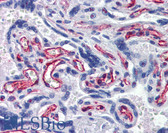 Anti-RASSF1 / RASSF1A Antibody (clone 114-10H1) IHC-plus LS-B3784