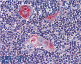 Anti-TARP / CD3G Antibody (clone TP1, a.k.a 1F8) IHC-plus LS-B3786