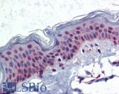 Anti-TNIP1 / VAN Antibody (clone 5C4) IHC-plus LS-B3790