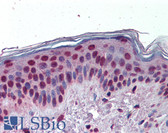 Anti-KDM1A / LSD1 Antibody (Internal) IHC-plus LS-B3800