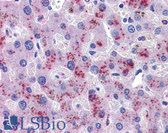 Anti-HPX / Hemopexin Antibody IHC-plus LS-B3811