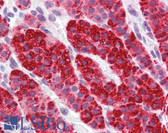 Anti-GATAD2B Antibody IHC-plus LS-B3823