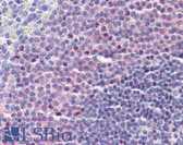 Anti-DDX58 / RIG-1 / RIG-I Antibody IHC-plus LS-B3834