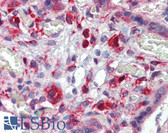Anti-AAK1 Antibody (N-Terminus) IHC-plus LS-B3843