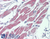 Anti-STK39 / SPAK Antibody (C-Terminus) IHC-plus LS-B3852