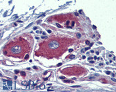 Anti-AIPL1 Antibody (Internal) IHC-plus LS-B3854