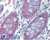 Anti-METTL7B Antibody (C-Terminus) IHC-plus LS-B3855