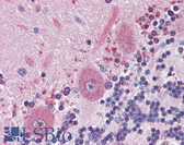 Anti-BRAF / B-Raf Antibody (clone 1H12) IHC-plus LS-B3862
