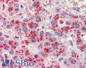 Anti-ALCAM / CD166 Antibody (clone 10F1G12) IHC-plus LS-B3883